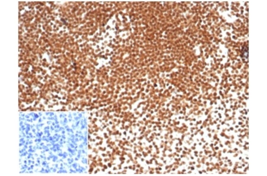 Immunohistochemistry - Anti-Nucleophosmin Antibody [NPM1/7072R] (A278038) - Antibodies.com