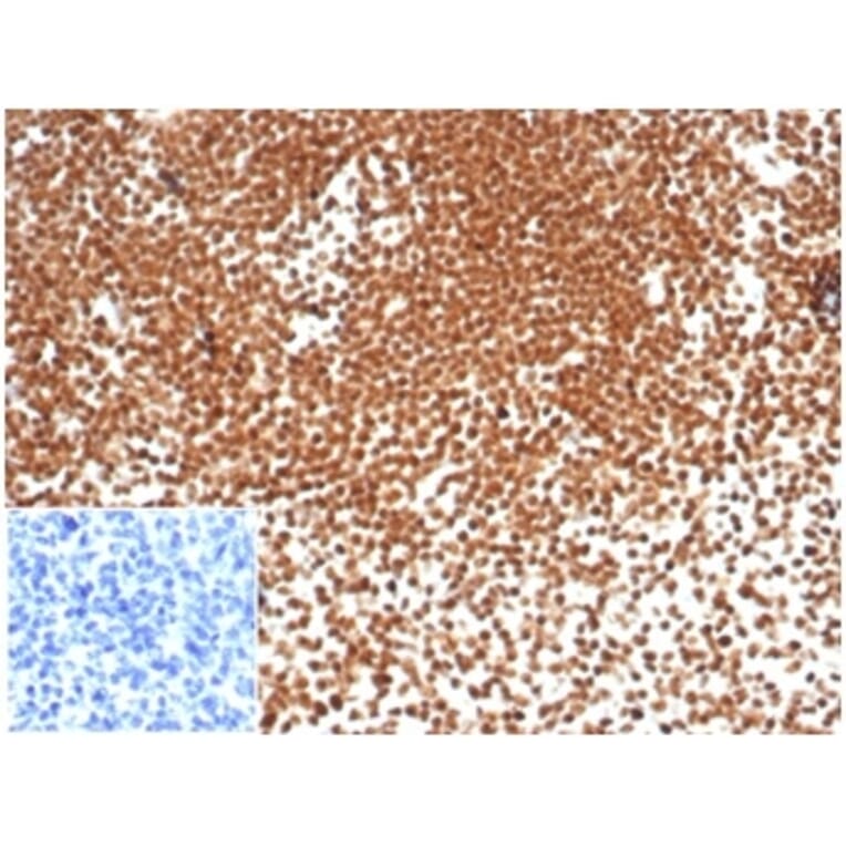 Immunohistochemistry - Anti-Nucleophosmin Antibody [NPM1/7072R] (A278038) - Antibodies.com