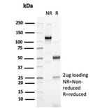 SDS-PAGE - Anti-PAX6 Antibody [PAX6/7078R] (A278039) - Antibodies.com