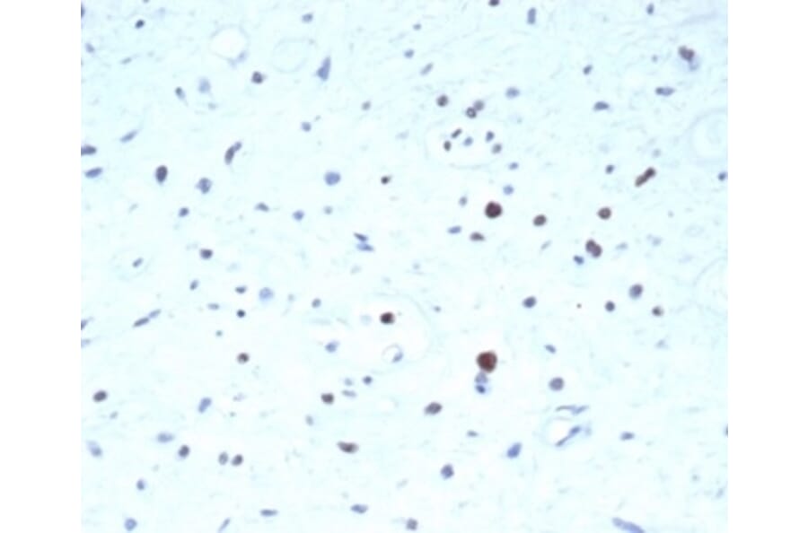 Immunohistochemistry - Anti-PAX7 Antibody [PAX7/7079R] (A278040) - Antibodies.com
