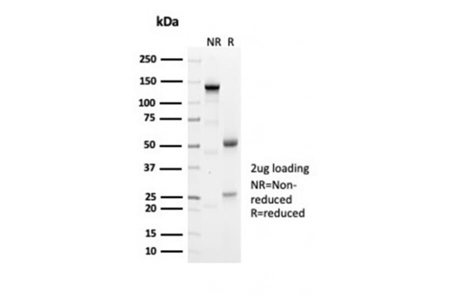 SDS-PAGE - Anti-Geminin Antibody [GMNN/7037R] (A278041) - Antibodies.com