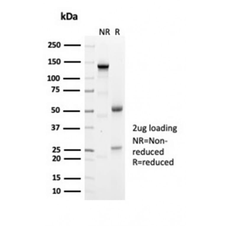 SDS-PAGE - Anti-Geminin Antibody [GMNN/7037R] (A278041) - Antibodies.com