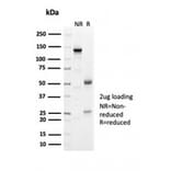 SDS-PAGE - Anti-Geminin Antibody [GMNN/7037R] (A278041) - Antibodies.com