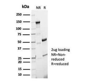SDS-PAGE - Anti-Phosphoglucomutase 5 Antibody [PGM5/7005R] (A278043) - Antibodies.com