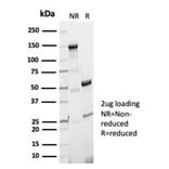 SDS-PAGE - Anti-Phosphoglucomutase 5 Antibody [PGM5/7005R] (A278043) - Antibodies.com