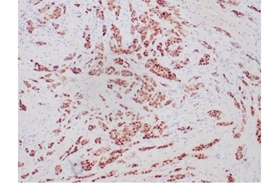 Immunohistochemistry - Anti-Progesterone Receptor Antibody [PGR/6854R] (A278044) - Antibodies.com