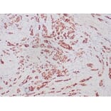 Immunohistochemistry - Anti-Progesterone Receptor Antibody [PGR/6854R] (A278044) - Antibodies.com