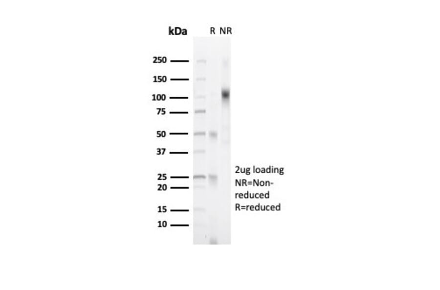 SDS-PAGE - Anti-Progesterone Receptor Antibody [PGR/6854R] (A278044) - Antibodies.com