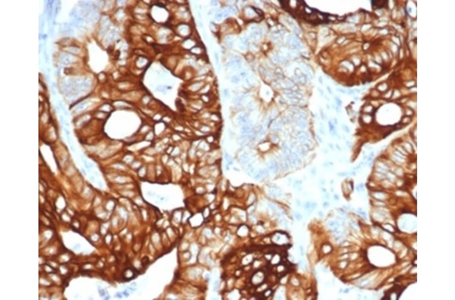Immunohistochemistry - Anti-Cytokeratin 20 Antibody [KRT20/4380R] (A278045) - Antibodies.com