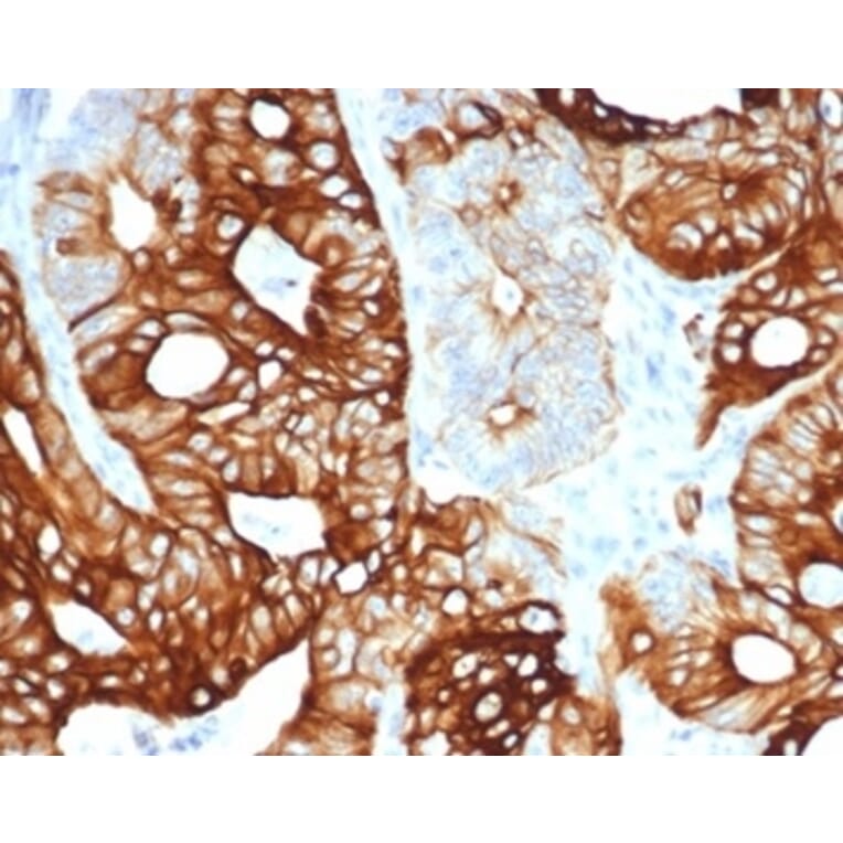 Immunohistochemistry - Anti-Cytokeratin 20 Antibody [KRT20/4380R] (A278045) - Antibodies.com