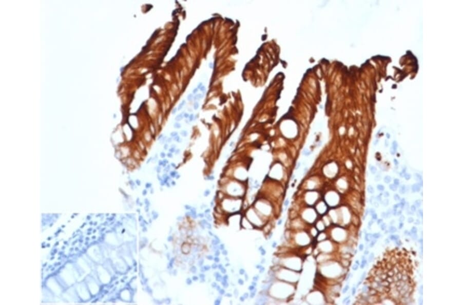 Immunohistochemistry - Anti-Cytokeratin 20 Antibody [KRT20/4879R] (A278046) - Antibodies.com
