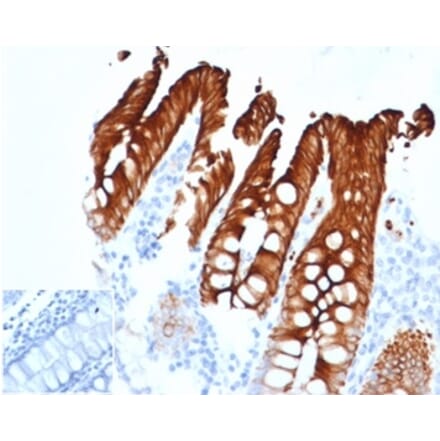 Immunohistochemistry - Anti-Cytokeratin 20 Antibody [KRT20/4879R] (A278046) - Antibodies.com