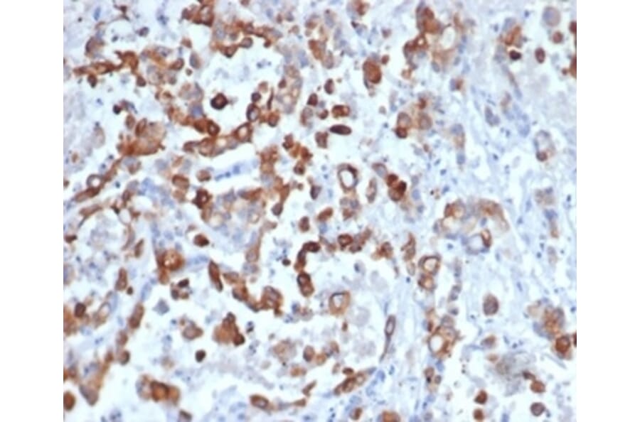 Immunohistochemistry - Anti-Cytokeratin 20 Antibody [KRT20/4879R] (A278046) - Antibodies.com