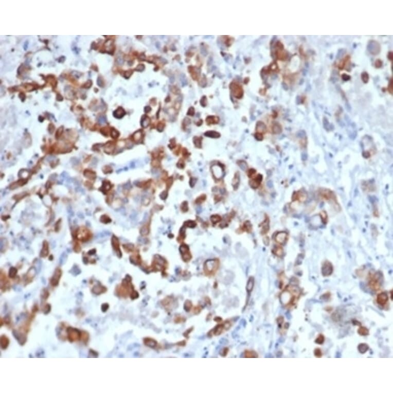 Immunohistochemistry - Anti-Cytokeratin 20 Antibody [KRT20/4879R] (A278046) - Antibodies.com