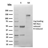 SDS-PAGE - Anti-Cytokeratin 20 Antibody [KRT20/4879R] (A278046) - Antibodies.com