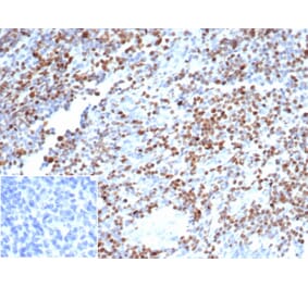 Immunohistochemistry - Anti-OCT-2 Antibody [OCT2/7073R] (A278047) - Antibodies.com