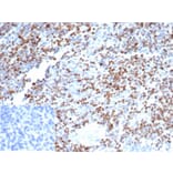 Immunohistochemistry - Anti-OCT-2 Antibody [OCT2/7073R] (A278047) - Antibodies.com