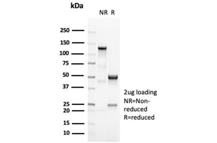 SDS-PAGE - Anti-OCT-2 Antibody [OCT2/7073R] (A278047) - Antibodies.com