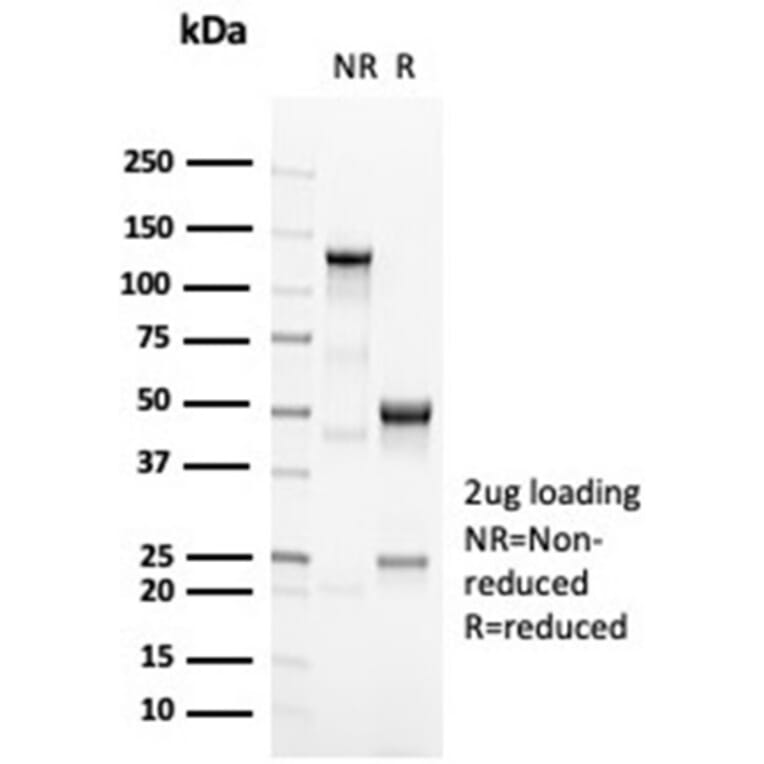 SDS-PAGE - Anti-OCT-2 Antibody [OCT2/7073R] (A278047) - Antibodies.com