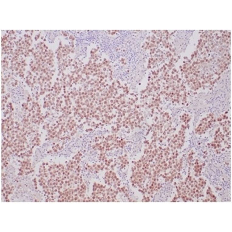 Immunohistochemistry - Anti-OCT-4 Antibody [OCT4/6875R] (A278048) - Antibodies.com