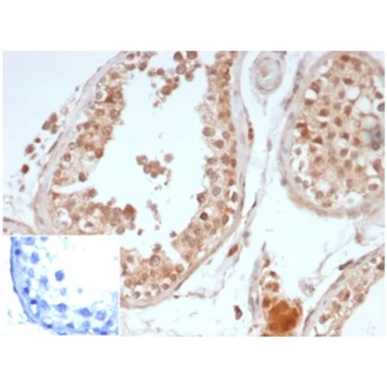 Immunohistochemistry - Anti-OCT-4 Antibody [OCT4/6875R] (A278048) - Antibodies.com