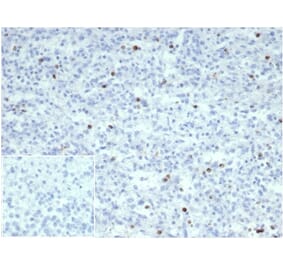 Immunohistochemistry - Anti-Perforin Antibody [PRF1/7077R] (A278049) - Antibodies.com
