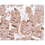 Immunohistochemistry - Anti-Prolactin Antibody [PRL/4906R] (A278050) - Antibodies.com