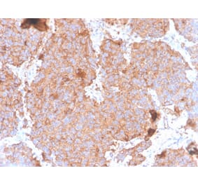 Immunohistochemistry - Anti-Prolactin Antibody [PRL/4908R] (A278051) - Antibodies.com