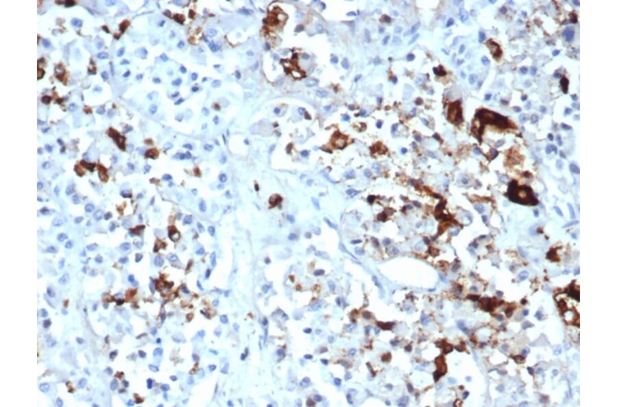 Immunohistochemistry - Anti-Prolactin Antibody [PRL/4908R] (A278051) - Antibodies.com