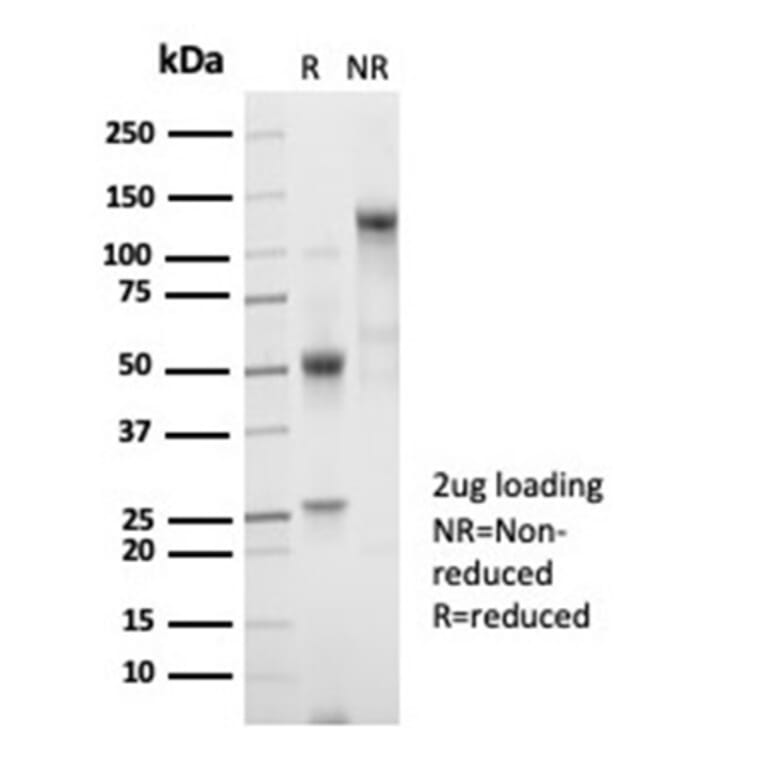 SDS-PAGE - Anti-beta 2 Microglobulin Antibody [B2M/7013R] (A278052) - Antibodies.com