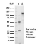 SDS-PAGE - Anti-beta 2 Microglobulin Antibody [B2M/7013R] (A278052) - Antibodies.com