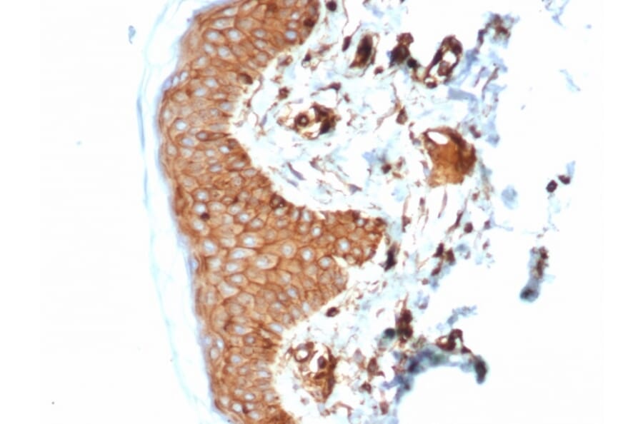 Immunohistochemistry - Anti-beta 2 Microglobulin Antibody [B2M/7013R] (A278052) - Antibodies.com