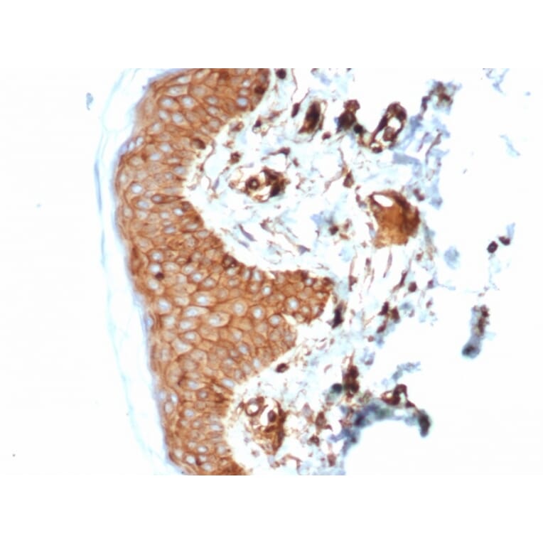 Immunohistochemistry - Anti-beta 2 Microglobulin Antibody [B2M/7013R] (A278052) - Antibodies.com