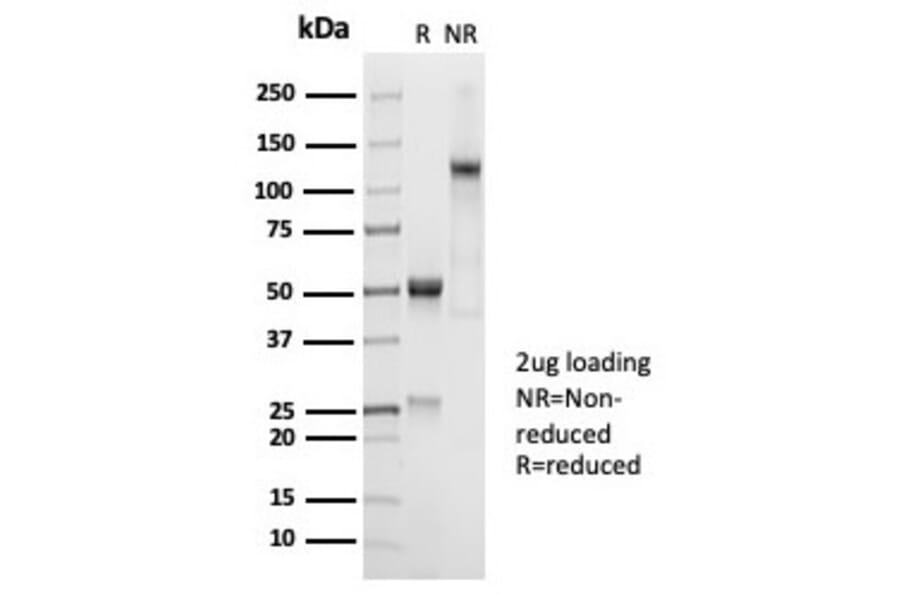 SDS-PAGE - Anti-CD45RA Antibody [PTPRC/7018R] (A278053) - Antibodies.com