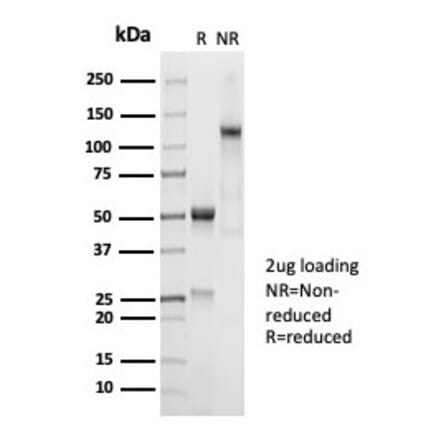 SDS-PAGE - Anti-CD45RA Antibody [PTPRC/7018R] (A278053) - Antibodies.com
