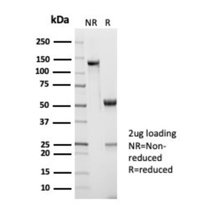 SDS-PAGE - Anti-CD45RA Antibody [PTPRC/7019R] (A278054) - Antibodies.com