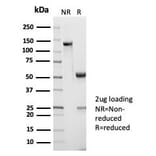 SDS-PAGE - Anti-CD45RA Antibody [PTPRC/7019R] (A278054) - Antibodies.com