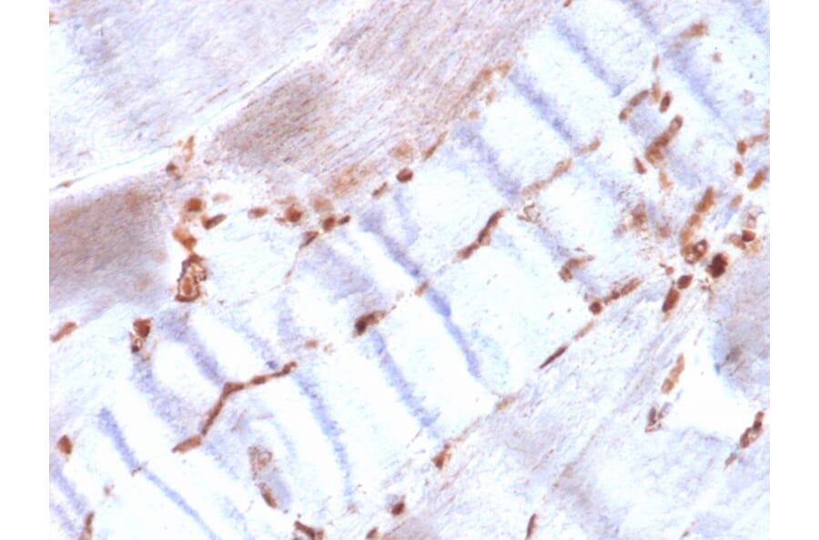 Immunohistochemistry - Anti-alpha Smooth Muscle Actin Antibody [ACTA2/1614R] (A278055) - Antibodies.com