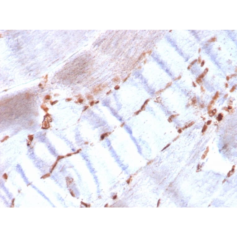 Immunohistochemistry - Anti-alpha Smooth Muscle Actin Antibody [ACTA2/1614R] (A278055) - Antibodies.com