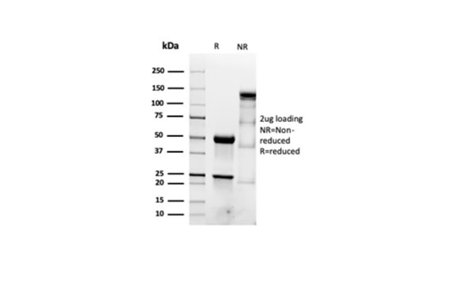 SDS-PAGE - Anti-alpha Smooth Muscle Actin Antibody [ACTA2/1614R] (A278055) - Antibodies.com
