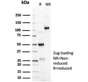 SDS-PAGE - Anti-ACE2 Antibody [ACE2/6788R] (A278056) - Antibodies.com