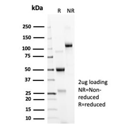 SDS-PAGE - Anti-ACE2 Antibody [ACE2/6788R] (A278056) - Antibodies.com