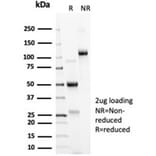 SDS-PAGE - Anti-ACE2 Antibody [ACE2/6788R] (A278056) - Antibodies.com
