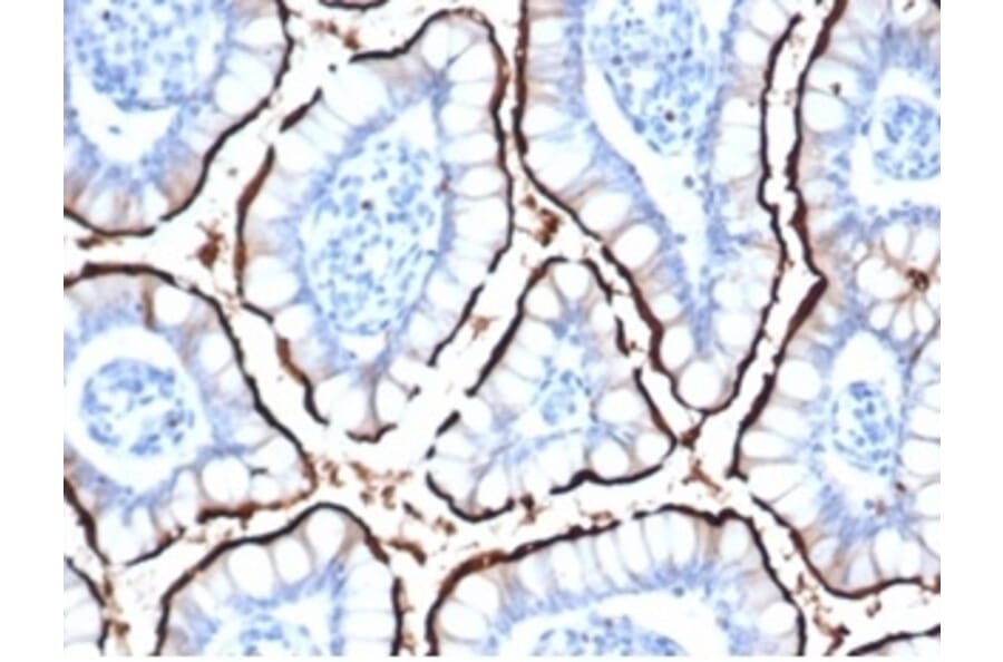 Immunohistochemistry - Anti-ACE2 Antibody [ACE2/6788R] (A278056) - Antibodies.com