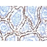 Immunohistochemistry - Anti-ACE2 Antibody [ACE2/6788R] (A278056) - Antibodies.com