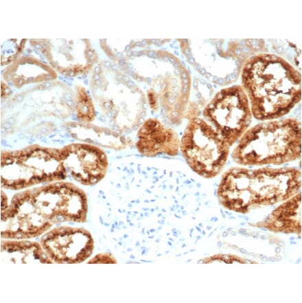 Immunohistochemistry - Anti-RBP4 Antibody [RBP4/7045R] (A278057) - Antibodies.com