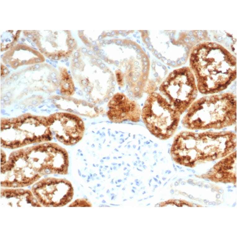 Immunohistochemistry - Anti-RBP4 Antibody [RBP4/7045R] (A278057) - Antibodies.com