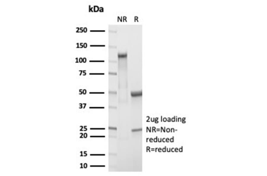 SDS-PAGE - Anti-RBP4 Antibody [RBP4/7045R] (A278057) - Antibodies.com
