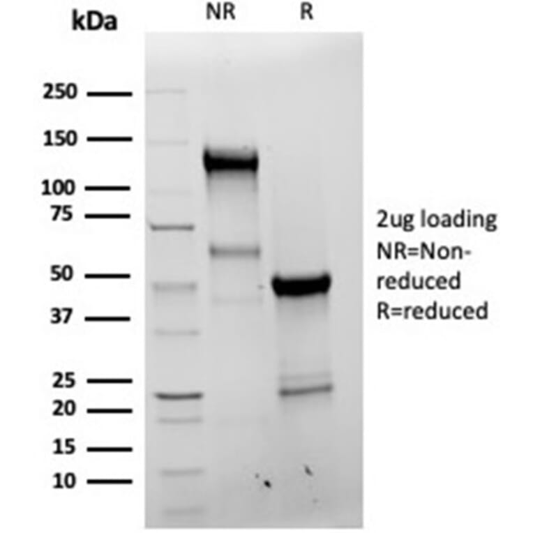 SDS-PAGE - Anti-Bcl-X Antibody [BCL2L1/4509R] (A278058) - Antibodies.com
