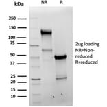 SDS-PAGE - Anti-Bcl-X Antibody [BCL2L1/4509R] (A278058) - Antibodies.com